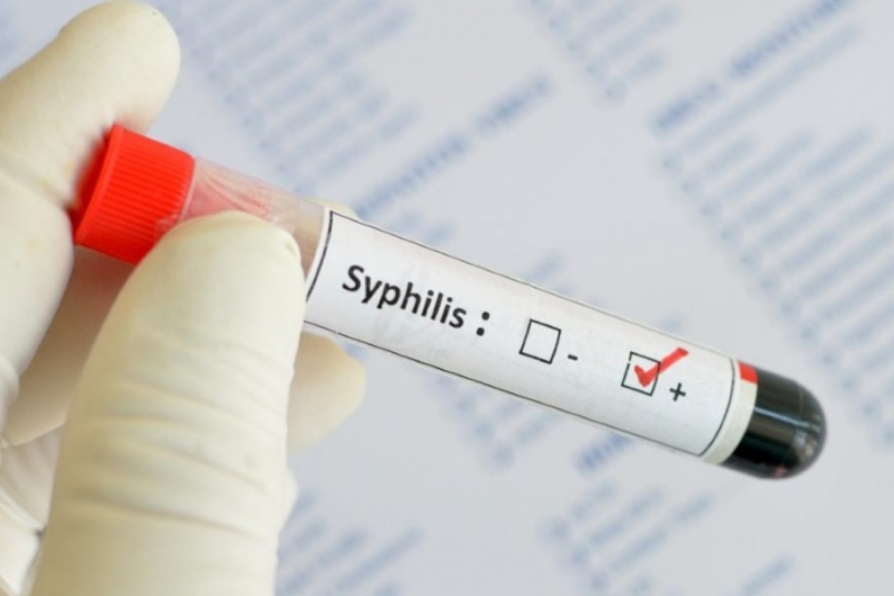 Сифилис: симптомы, признаки, лечение и профилактика